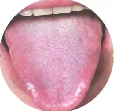 59fac7844ab70aa34fdc5958e873da3.png